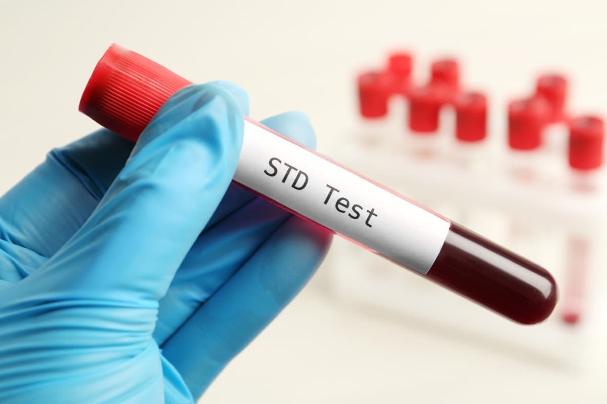Gloved hand holding a blood sample tube labeled STD test, representing laboratory sexual health screening